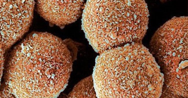 Hormone gây đói giúp tăng tuổi thọ 