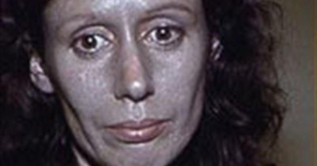 Giải mã hiện tượng người uống bạc thành da xanh 