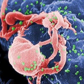 Cảm biến phát hiện virus HIV bằng mắt thường