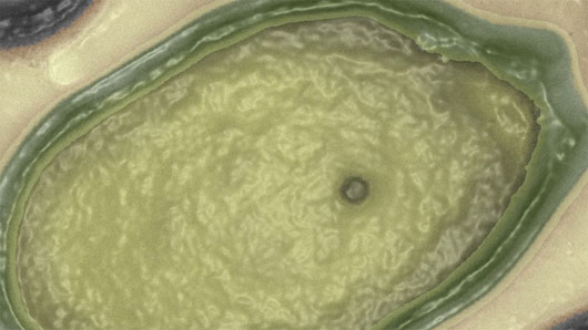 Pandoravirus - liên kết thiếu được phát hiện giữa virus và tế bào