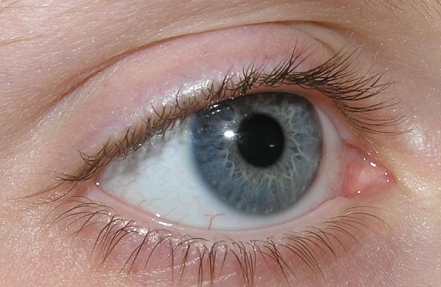 Trị bệnh mù mắt một phần bằng dòng điện kích thích không xâm lấn