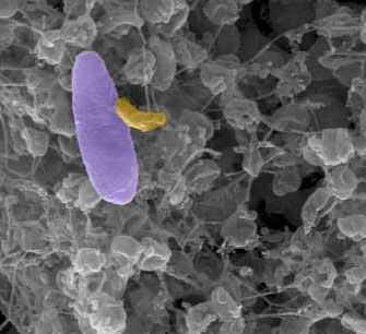 Biến vi khuẩn “ma cà rồng” thành kháng sinh sống