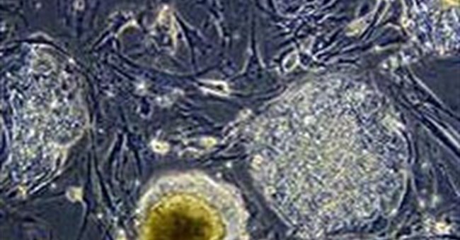 Đột phá trong nghiên cứu về "cải lão hoàn đồng"