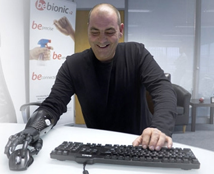 Bàn tay robot Bebionic3 - Tương lai của Cyborg không còn xa