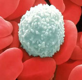 Phát hiện nguy cơ ung thư máu do nhiễm xạ liều thấp