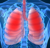 Mối đe dọa lớn của bệnh tắc nghẽn phổi mãn tính