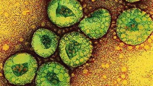 Virus corona gây bệnh SARS được tìm thấy trên mô phổi năm 2003