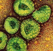 Phát hiện 4 bệnh nhân nhiễm virus gây ra bệnh SARS