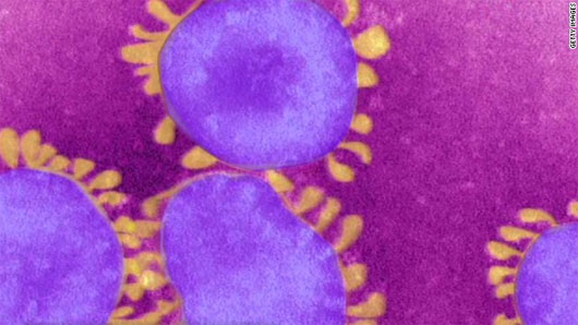 Phát hiện ca nhiễm virus giống SARS ở Tây Ban Nha