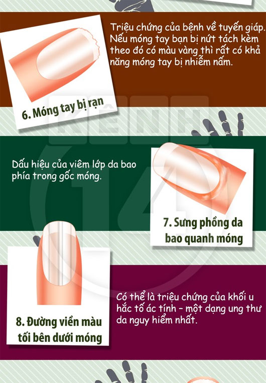 Màu sắc móng tay 