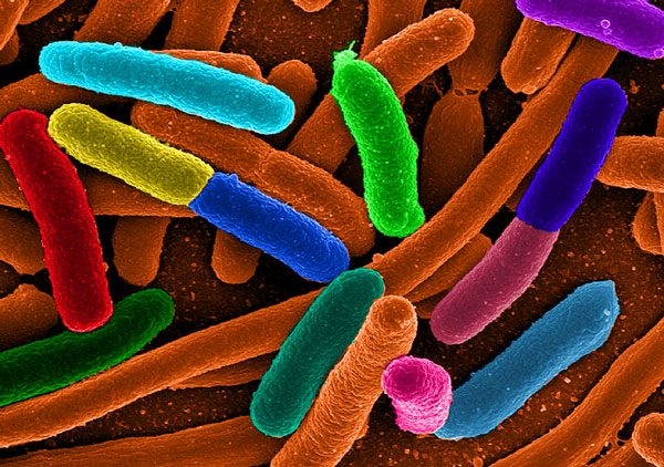 Cảm biến không dây awiss giúp phát hiện vi khuẩn e.coli trong nước