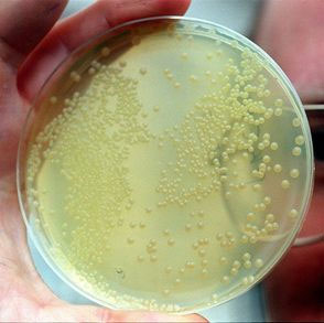 Anh: Độ nhiễm khuẩn e.coli ở nguồn cung cấp nước sạch tăng 5 lần