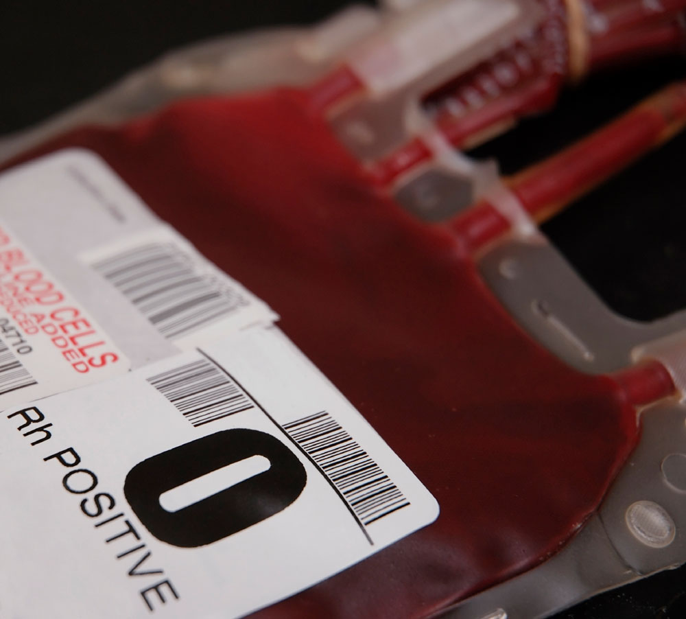 Dùng tế bào gốc điều trị bệnh thiếu máu di truyền 