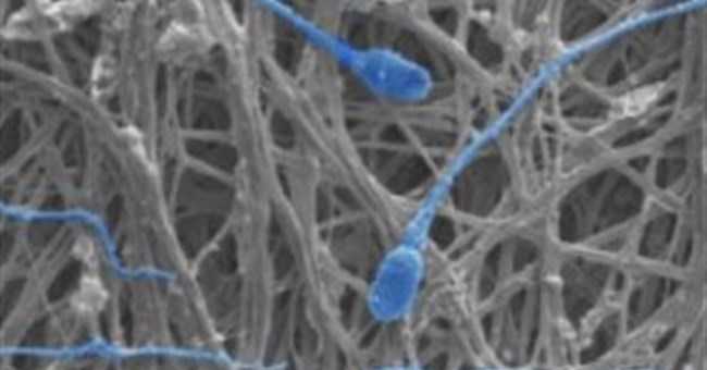 Ngừa thai và HIV bằng vải