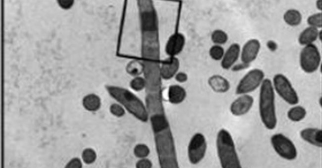 Hành vi lạ lùng của vi khuẩn với protein nhân tạo