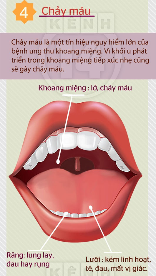 7 dấu hiệu 