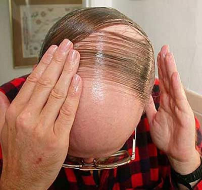 Phát hiện gene tái tạo tóc, da