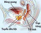 Cắt bỏ tuyến tiền liệt dễ gây bất lực
