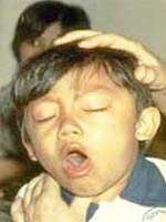 Chứng ho lâu ngày ở trẻ