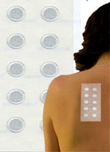 Patch Test: Xét nghiệm tìm nguyên nhân gây dị ứng