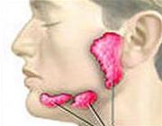 Hội chứng khô mắt khô miệng