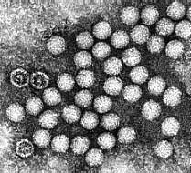 Ninh Thuận: thêm 20 bệnh nhi nhiễm virus đường tiêu hóa