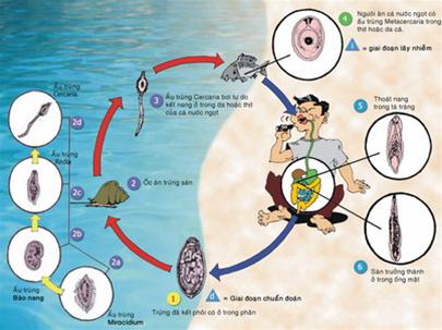 Ăn gỏi cá sống: Coi chừng sướng miệng, khổ thân