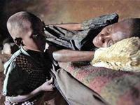 Số bệnh nhân AIDS ở nước nghèo được điều trị chưa đạt mục tiêu
