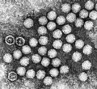 Ứng dụng kỹ thuật PCR để chẩn đoán viêm não, viêm màng não