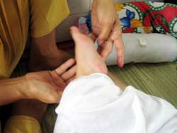 Bệnh tay, chân, miệng: Cảnh báo biến chứng thần kinh