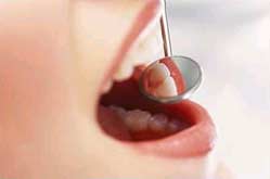 Các bệnh nha chu ở trẻ em