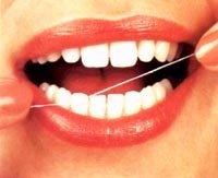 Xỉa răng lung tung gây viêm lợi