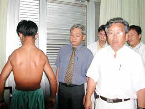 Nguy hiểm khi chích vào cơ tứ đầu đùi và cơ Delta ở trẻ em