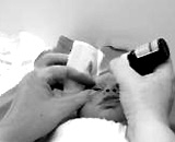 Viêm kết mạc ở trẻ sơ sinh