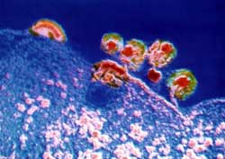 Thuốc thử định lượng HIV