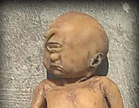 Em bé một mắt ra đời ở Ấn Độ