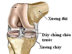 Chấn thương dây chằng chéo trước
