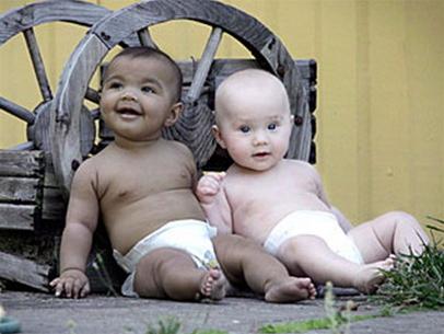 Cặp song sinh “đen, trắng”