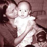 Em bé có bàn tay gấu