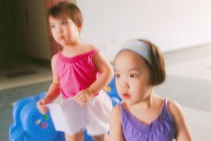 Hai bé dính nhau được tách rời đã bình thường
