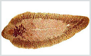 Ăn rau muống chẻ coi chừng xơ gan