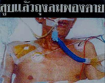 Hiệu quả cảnh báo trên bao bì thuốc lá