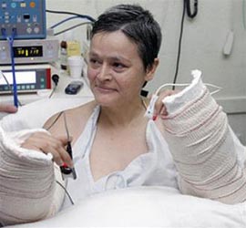 Lại có tay sau 28 năm
