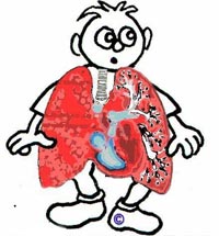 VN có tỉ lệ mắc bệnh phổi mãn tính cao nhất khu vực