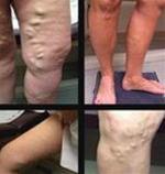 Cảnh giác trước những thay đổi bất thường của cơ thể