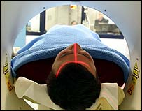 Scan cho thấy não phác họa tương lai như thế nào