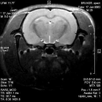 Hàn Quốc: Thiết bị MRI mới có đội phân giải cao