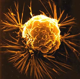 Trị bệnh ung thư bằng virus
