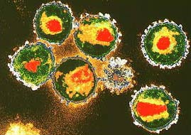 Các nhà nghiên cứu phát triển một cách xét nghiệm có độ nhạy hơn để tìm HIV kháng thuốc