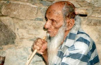 Chiếc sừng kỳ lạ của cụ già Yemen